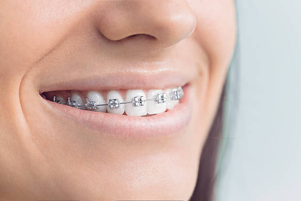 Why Choose Us for Your Dental Needs in Guernsey, WY